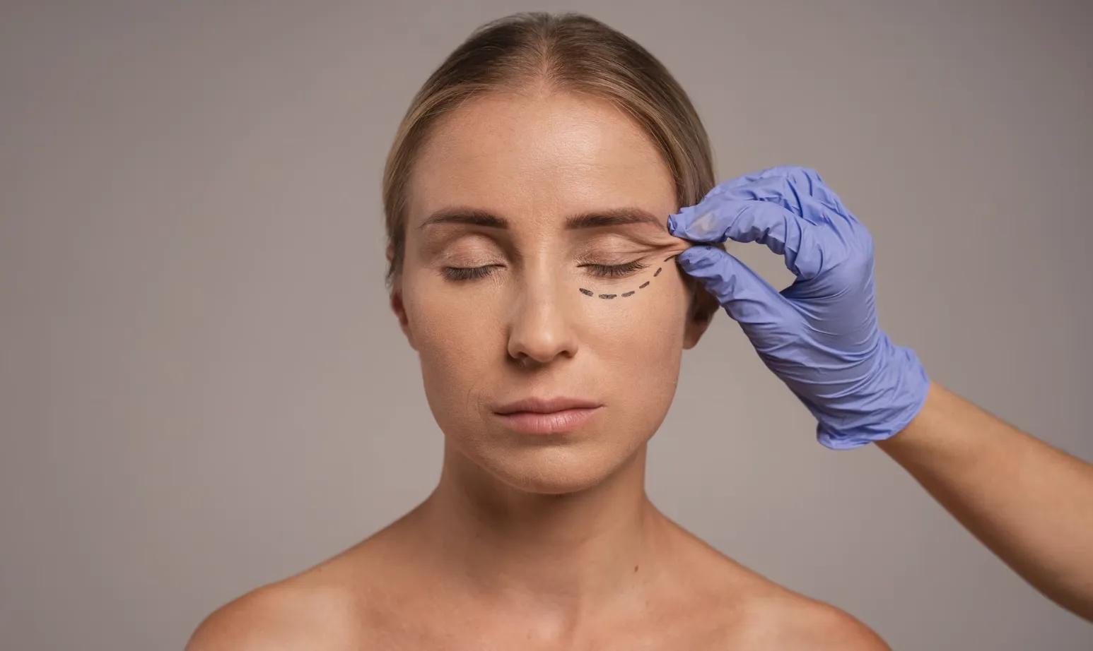 Blefaroplastia Inferior
