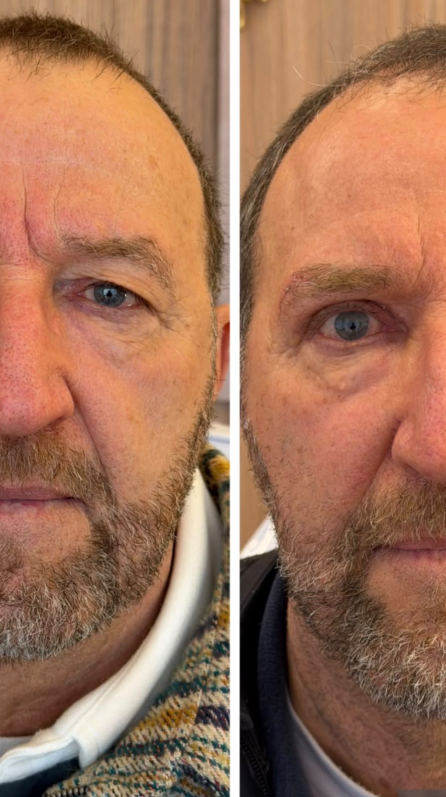 Antes e Depois Masculino 3