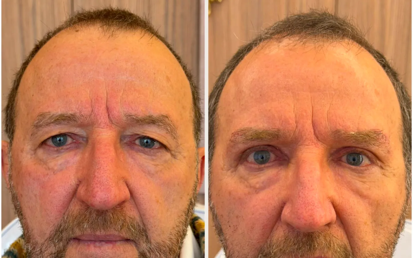 Antes e Depois - Caso 5