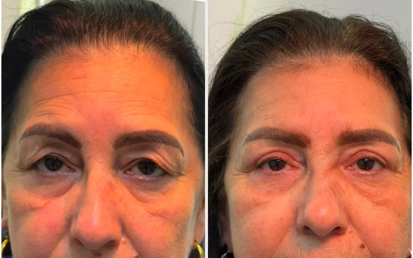 Antes e Depois - Caso 7